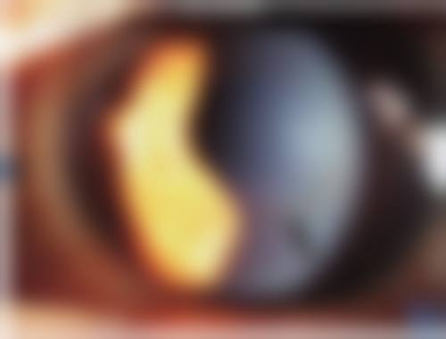 中医和西医结合特色项目,全方面解决眼疾困扰