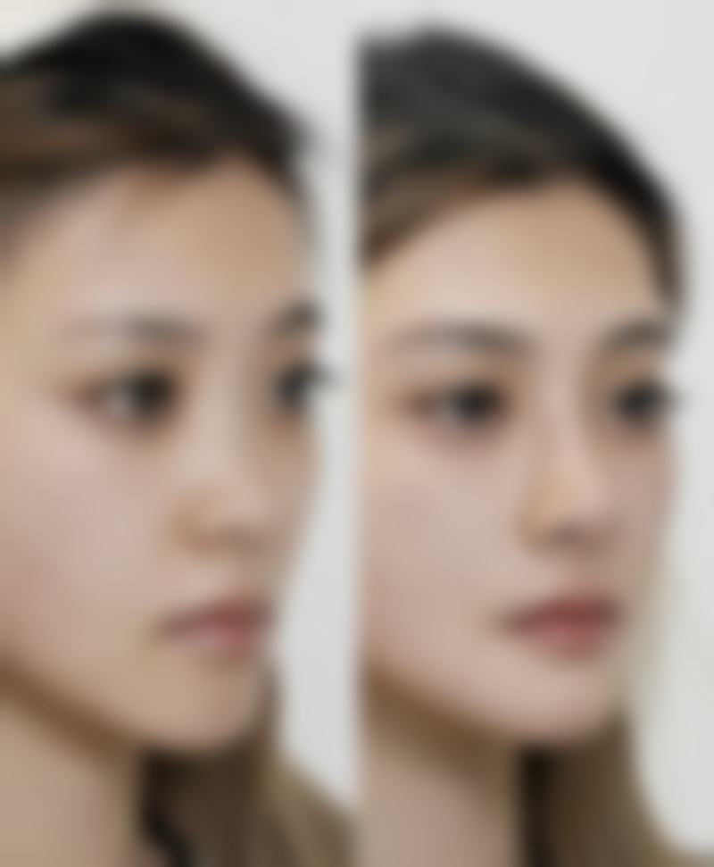 【宜昌禧满医疗美容诊所特色项目：】