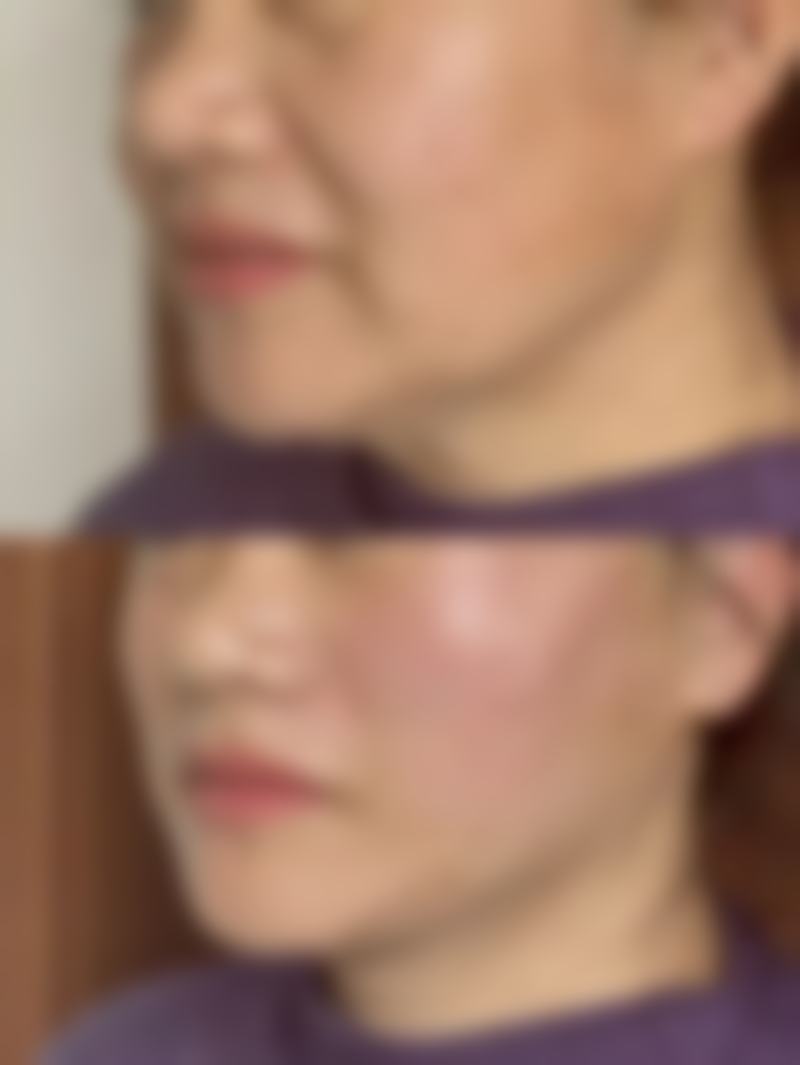 【赵菲菲医生擅长项目：】