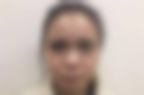 瘦脸针的价格情况