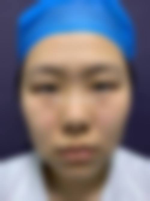 张宇恒和张为宝在青岛麦若兰医学美容医院解决青春痘问题值不值?