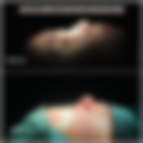 【深圳凤贤妇科医院整形科怎么预约挂号?】