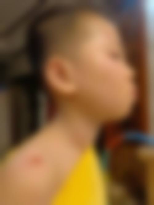 精良设备与特色眼科项目