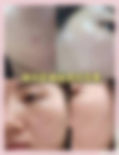 擅长项目详解:谢舜贤+佛山广大壹美医疗美容整形门诊部+核心项目