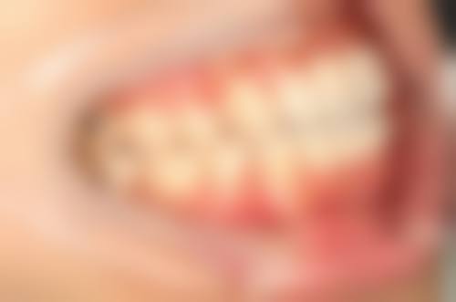 结语:选择博雅美格,重拾自信笑容