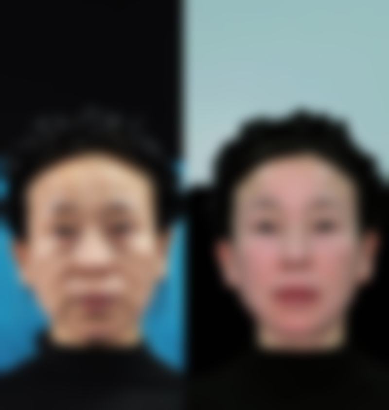 【吴建利医生擅长项目】