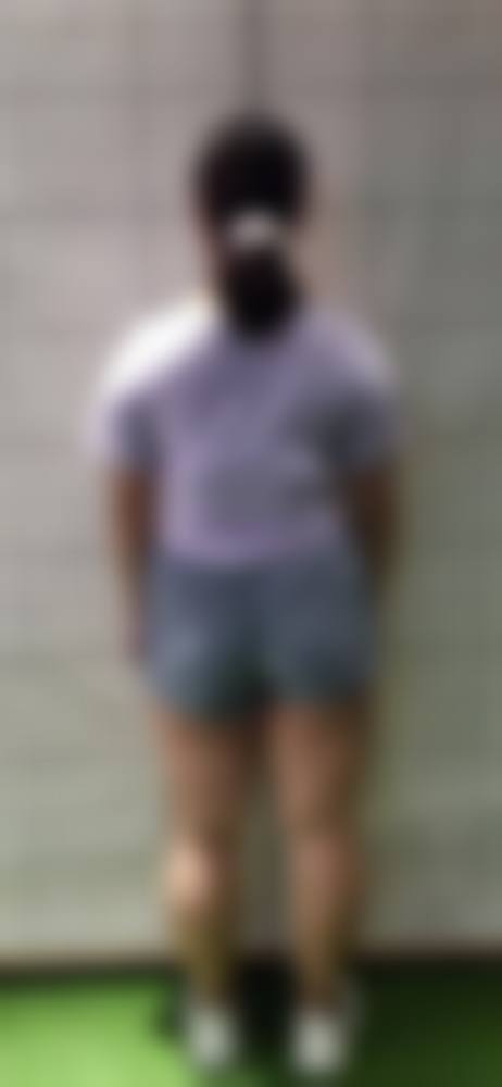 【南京薇美医疗美容诊所参考价格表:】