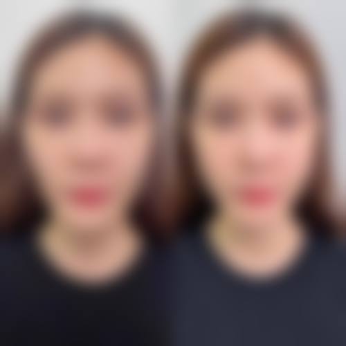 【杭州树兰医院整形美容科特色项目：】