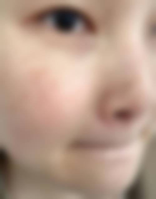 擅长项目详解：许娟医生核心疗法