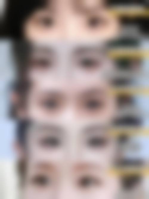 患者真实评价北京海医悦美医疗美容门诊部韩玉