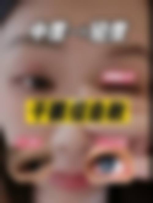 结尾预约号召:长沙市中医医院眼科刘照耀