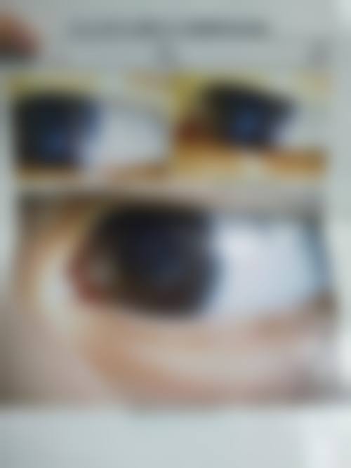 高端设备加持,精细诊疗守护清晰视界