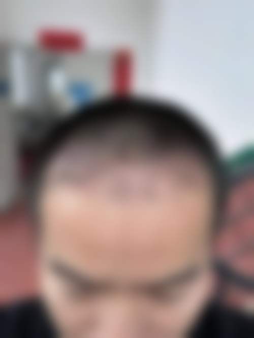 诊疗特色总结:李荣发医生的技术特点有哪些?