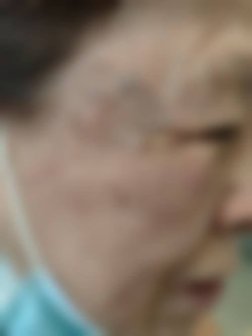 结尾预约号召北京海医悦美医疗美容门诊部韩玉