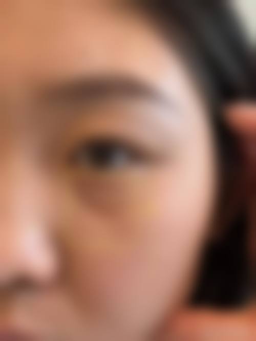 预约优惠活动北京海医悦美医疗美容门诊部韩玉