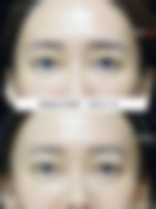 临床实例分享:真实反馈见证技术实力