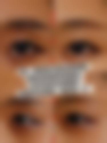 擅长项目详解:精细解决面部美学问题