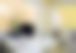 南宁美丽焦点医疗美容医院【自然放大】眼综合｜双眼皮+开眼角 灵动有神 3100元