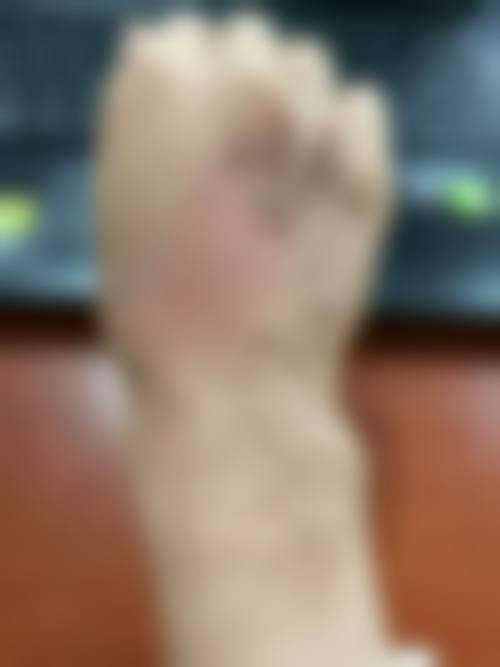 预约优惠活动:现在预约有什么补贴?