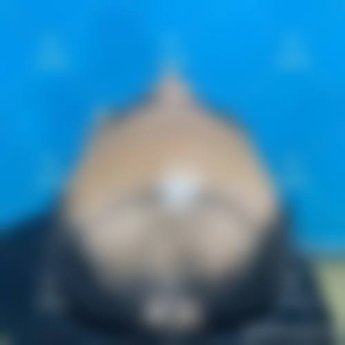 擅长项目详解:姜敏医生适合我做这个项目吗?