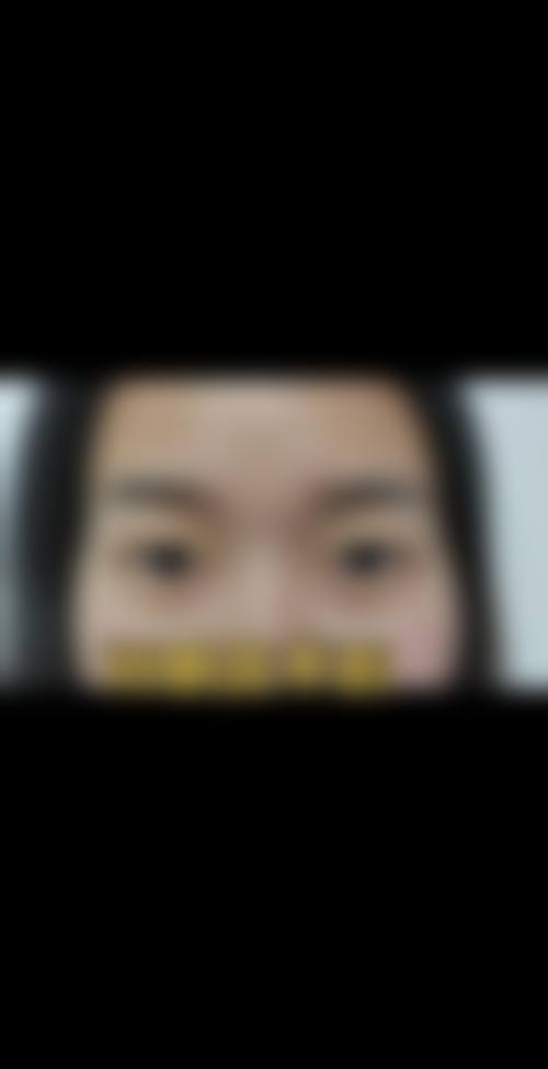 结尾预约号召:守护孩子明亮双眸