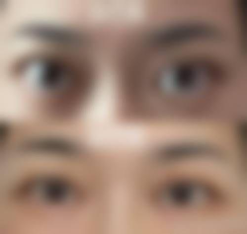 临床实例分享:真实诊疗成效见证