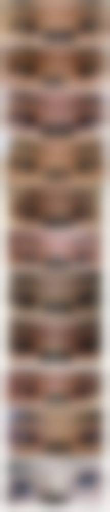 擅长项目详解:面部整形与形体雕塑