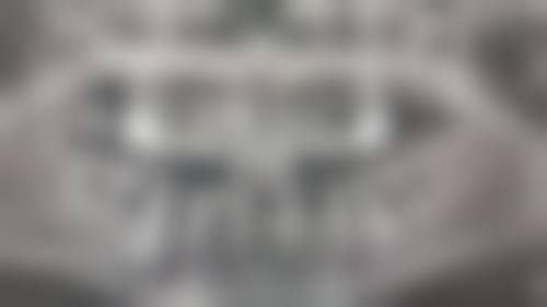 引进前列数字化设备,精细效率高治疗牙齿