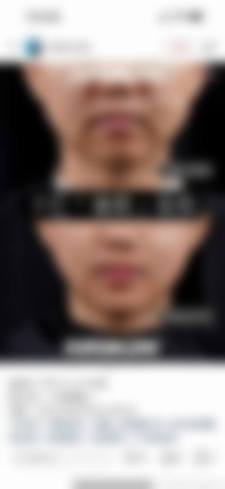 FAQ:常见疑问解答
