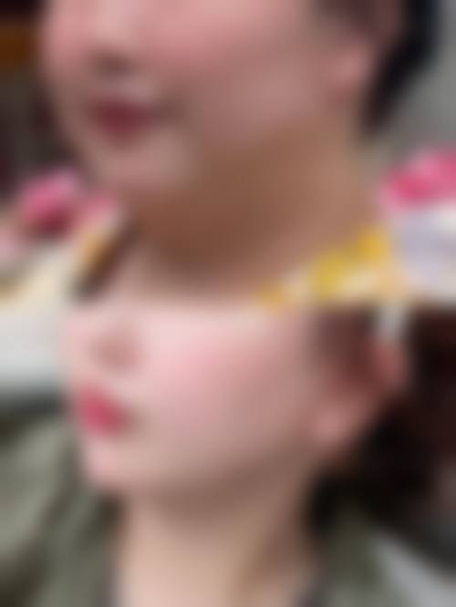 诊疗特色总结:达州仁美医学整形美容门诊部周院长的手术风格有何不同?