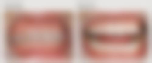 特色科室与项目:数字化技术引领精细诊疗