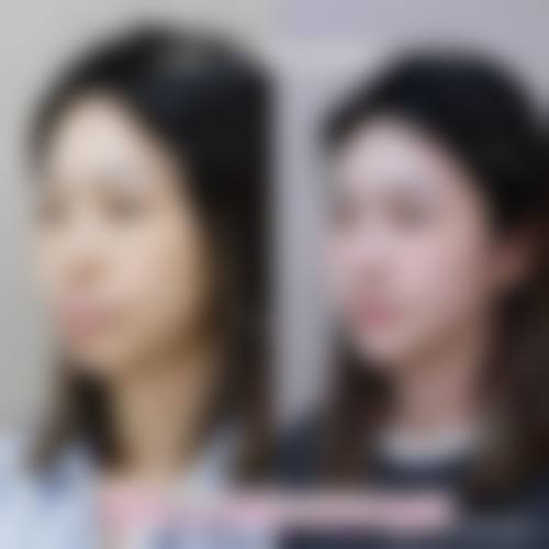 透明价格体系与优惠活动