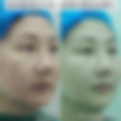 价格透明与优惠活动:高性价比之选