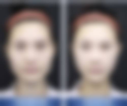 擅长项目详解上海正璞惠世医疗美容门诊部慈光华