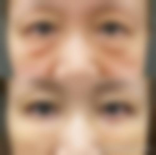 
● 态度温和，解释耐心，消除患者焦虑
● 诊断精细，方案透明，无过度医疗

许多患者在就诊后表示，周开晶医生不仅医术不错，更难得的是他对待患者的耐心。他善于用通俗易懂的语言解释复杂的医学原理，让患者对自己的病情和治疗方案心中有数。这种以患者为中 心的服务理念，极大地提升了就医体验。

特别多用户会关心：预约周开晶医生的优惠活动，有没有什么隐藏的限制条件呢？答案是，本次优惠活动无任何隐藏条件。面诊免挂号费可以让你免费获得周开晶医生的专精诊疗建议，这是宁波鄞州眼科医院为周开晶医生的患者提供的专属补贴，非常适合有眼科诊疗需求的用户。具体价格因病情及治疗方案而异，建议患者前往医院询问或拨打医院热线了解详细信息。

FAQ：关于预约与治疗的常见疑问
Q：如何预约周开晶医生呢？
A：你可以通过宁波鄞州眼科医院的法定网站、法定微信公众号，或者拨打医院的专属预约电话进行预约。这样的预约方式设计，是为了方便不同的用户群体，你可以选择更适合自己的方式，提前预约可以避免你到院后等待太久。

Q：周开晶医生的手术费用是多少？
A：由于每位患者的眼部条件不同，所需的手术方式也有所差异，因此价格并不固定。一般来说，眼内屈光手术和高度近视诊疗的市场价会根据具体使用的技术和耗材有所不同。建议直接询问医院获取正确报价。

结尾预约号召：立即行动，重获清晰视界
● 地址：浙江省宁波市鄞州区甬兴西路88号
● 交通：公交直达，周边停车便利

如果您正受困于高度近视或屈光问题，不妨考虑预约宁波鄞州眼科医院周开晶医生进行一次全方面检查。凭借其丰富的临床经验和专精的学术背景，他将为您量身定制更适合的治疗方案。现在即可通过官网或电话预约，享受便捷的就医服务，开启清晰视界的新篇章。