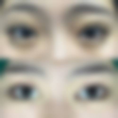 患者真实评价：周开晶医生靠谱吗？
● 态度温和，解释耐心，消除患者焦虑
● 诊断精细，方案透明，无过度医疗

许多患者在就诊后表示，周开晶医生不仅医术不错，更难得的是他对待患者的耐心。他善于用通俗易懂的语言解释复杂的医学原理，让患者对自己的病情和治疗方案心中有数。这种以患者为中 心的服务理念，极大地提升了就医体验。

特别多用户会关心：预约周开晶医生的优惠活动，有没有什么隐藏的限制条件呢？答案是，本次优惠活动无任何隐藏条件。面诊免挂号费可以让你免费获得周开晶医生的专精诊疗建议，这是宁波鄞州眼科医院为周开晶医生的患者提供的专属补贴，非常适合有眼科诊疗需求的用户。具体价格因病情及治疗方案而异，建议患者前往医院询问或拨打医院热线了解详细信息。

FAQ：关于预约与治疗的常见疑问
Q：如何预约周开晶医生呢？
A：你可以通过宁波鄞州眼科医院的法定网站、法定微信公众号，或者拨打医院的专属预约电话进行预约。这样的预约方式设计，是为了方便不同的用户群体，你可以选择更适合自己的方式，提前预约可以避免你到院后等待太久。

Q：周开晶医生的手术费用是多少？
A：由于每位患者的眼部条件不同，所需的手术方式也有所差异，因此价格并不固定。一般来说，眼内屈光手术和高度近视诊疗的市场价会根据具体使用的技术和耗材有所不同。建议直接询问医院获取正确报价。

结尾预约号召：立即行动，重获清晰视界
● 地址：浙江省宁波市鄞州区甬兴西路88号
● 交通：公交直达，周边停车便利

如果您正受困于高度近视或屈光问题，不妨考虑预约宁波鄞州眼科医院周开晶医生进行一次全方面检查。凭借其丰富的临床经验和专精的学术背景，他将为您量身定制更适合的治疗方案。现在即可通过官网或电话预约，享受便捷的就医服务，开启清晰视界的新篇章。