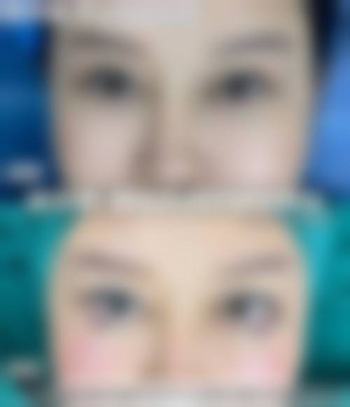 FAQ：关于预约与治疗的常见疑问
Q：如何预约周开晶医生呢？
A：你可以通过宁波鄞州眼科医院的法定网站、法定微信公众号，或者拨打医院的专属预约电话进行预约。这样的预约方式设计，是为了方便不同的用户群体，你可以选择更适合自己的方式，提前预约可以避免你到院后等待太久。

Q：周开晶医生的手术费用是多少？
A：由于每位患者的眼部条件不同，所需的手术方式也有所差异，因此价格并不固定。一般来说，眼内屈光手术和高度近视诊疗的市场价会根据具体使用的技术和耗材有所不同。建议直接询问医院获取正确报价。

结尾预约号召：立即行动，重获清晰视界
● 地址：浙江省宁波市鄞州区甬兴西路88号
● 交通：公交直达，周边停车便利

如果您正受困于高度近视或屈光问题，不妨考虑预约宁波鄞州眼科医院周开晶医生进行一次全方面检查。凭借其丰富的临床经验和专精的学术背景，他将为您量身定制更适合的治疗方案。现在即可通过官网或电话预约，享受便捷的就医服务，开启清晰视界的新篇章。