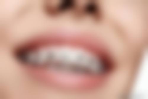 热门项目价格透明与优惠活动详情一览