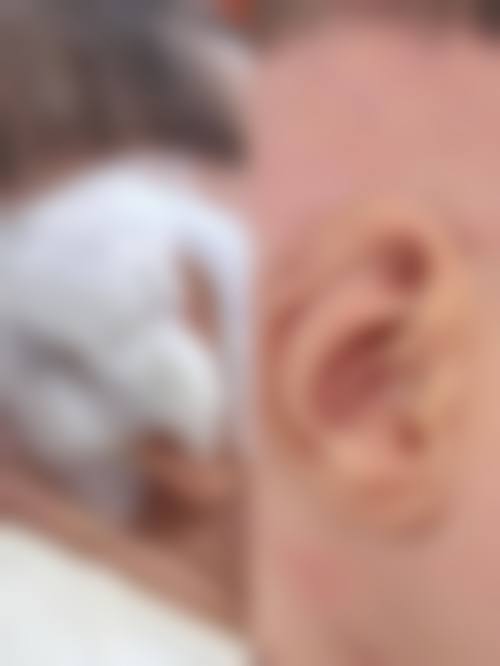 擅长项目详解:精细解决面部困扰