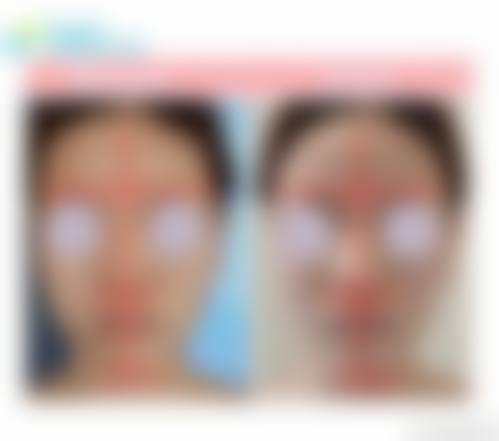 患者真实评价:口碑见证实力