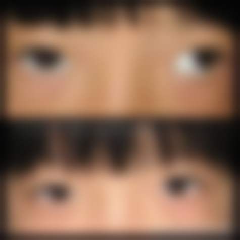 浙江省眼科医院富阳院区