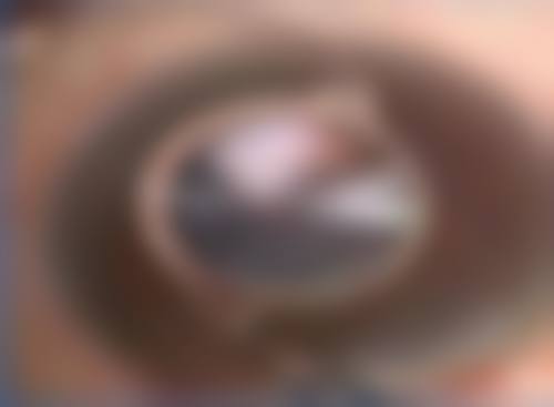 临床实例分享