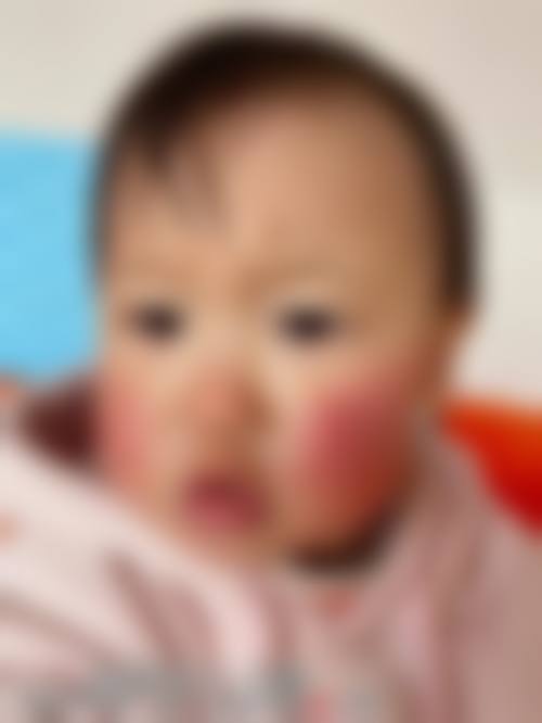 擅长项目详解:苏锐锋+承德医学校附属医院眼科+核心项目