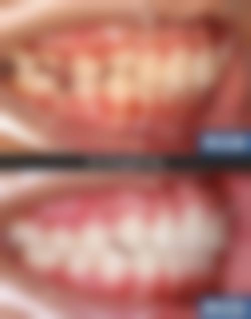 预约优惠活动