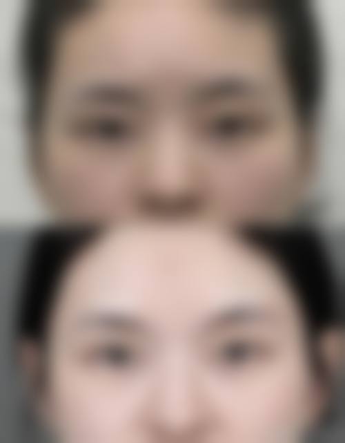 核心整形项目与技术优势分析