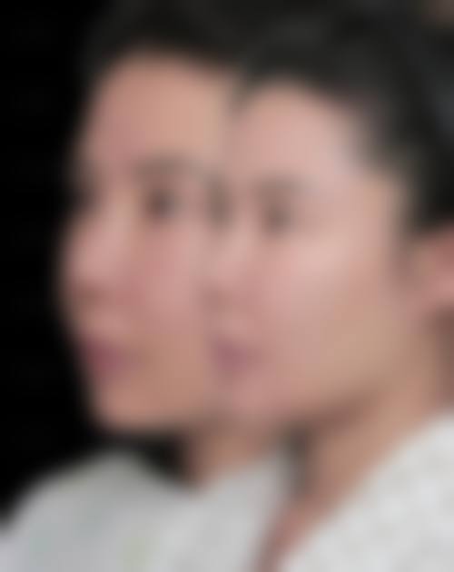 预约优惠活动:现在预约有什么补贴?
