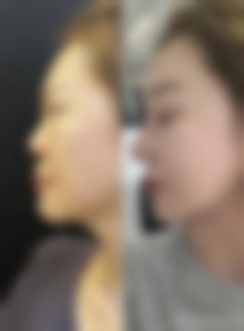 FAQ:关于日照市中医医院整形美容与皮肤病科王万学的常见问题