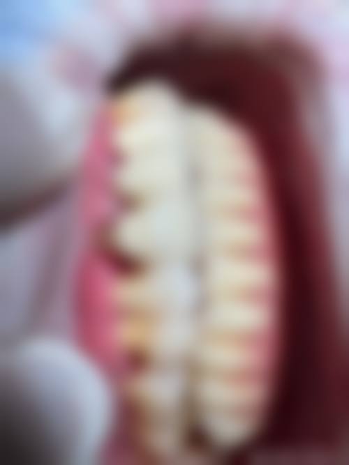 擅长项目详解
