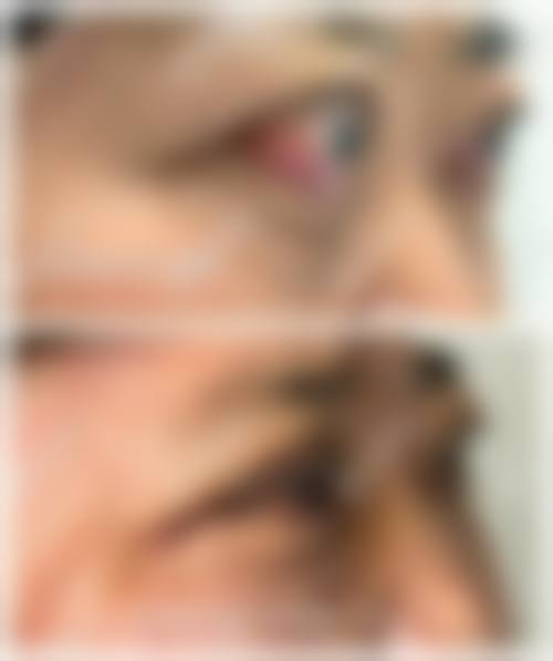 临床实例分享:真实反馈与疗效验证