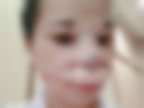 瘦脸针的第二天鼓腮了正常吗?鼓包的不同情况解读